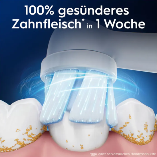 Oral-B Oral-B iO Gentle Care Aufsteckbürsten Weiß – 8 Stück