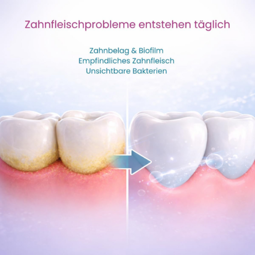 Miradent OXYSAFE Pro² Aktiv-Sauerstoff Zahnpasta – 75 ml Miradent Miradent OXYSAFE Pro² Aktiv-Sauerstoff Zahnpasta – 75 ml