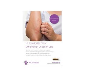 HFL Laboratories HFL Laboratories Flyers Fresh Gel Processierups - Consument 50 stuks HFL Laboratories HFL Laboratories Flyers Fresh Gel Processierups - Consument 50 stuks