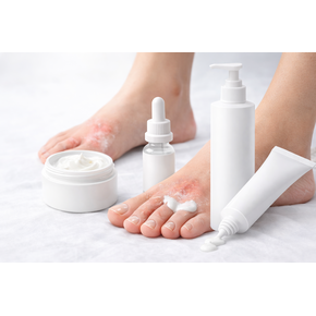 Huidaandoeningen & Irritatie