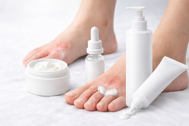 Huidaandoeningen & irritatie