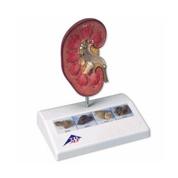 Urologie