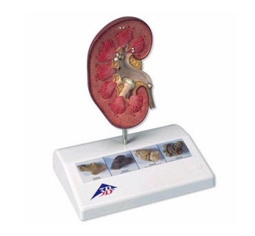 Anatomische nier- en prostaatmodellen voor urologie