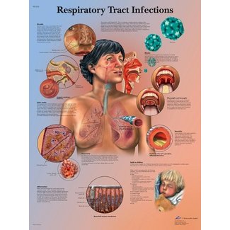 3B Scientific Anatomische Poster Respiratory Tract Infections