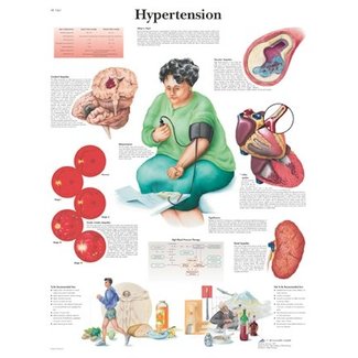 3B Scientific Anatomische Poster Hypertention