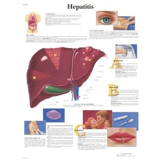 3B Scientific Anatomische Poster Hepatitis