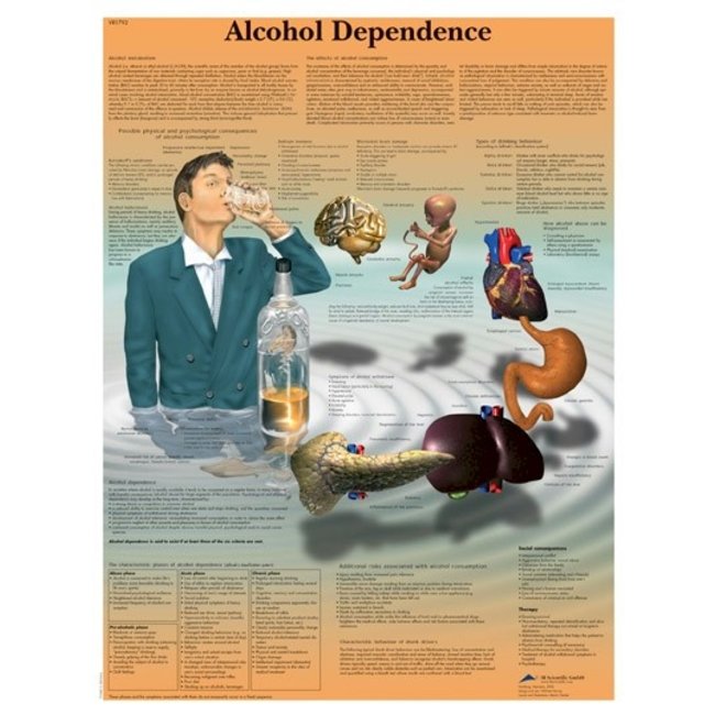 3B Scientific Anatomische Poster Alcohol Dependance / Alcohol afhankelijkheid