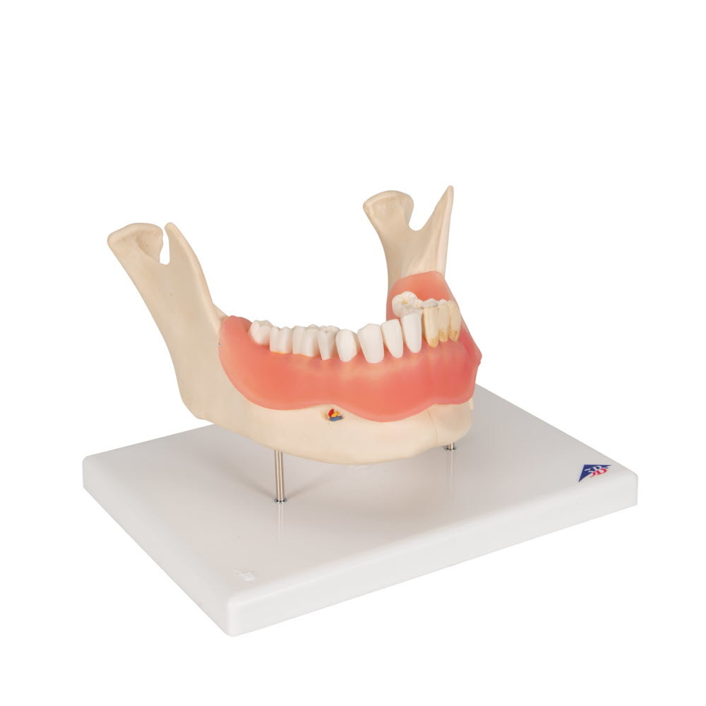 3B Scientific Anatomisch model van de onderkaak, 21 delig, foto 2 van 6
