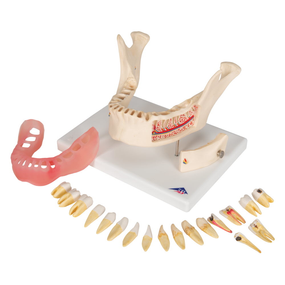 3B Scientific Anatomisch model van de onderkaak, 21 delig, foto 3 van 6