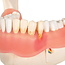 3B Scientific Anatomisch model van de onderkaak, 21 delig