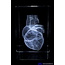 3D model van het menselijk hart in glazen blok