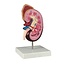Erler Zimmer Anatomisch model van de Nier, 2 maal vergroot