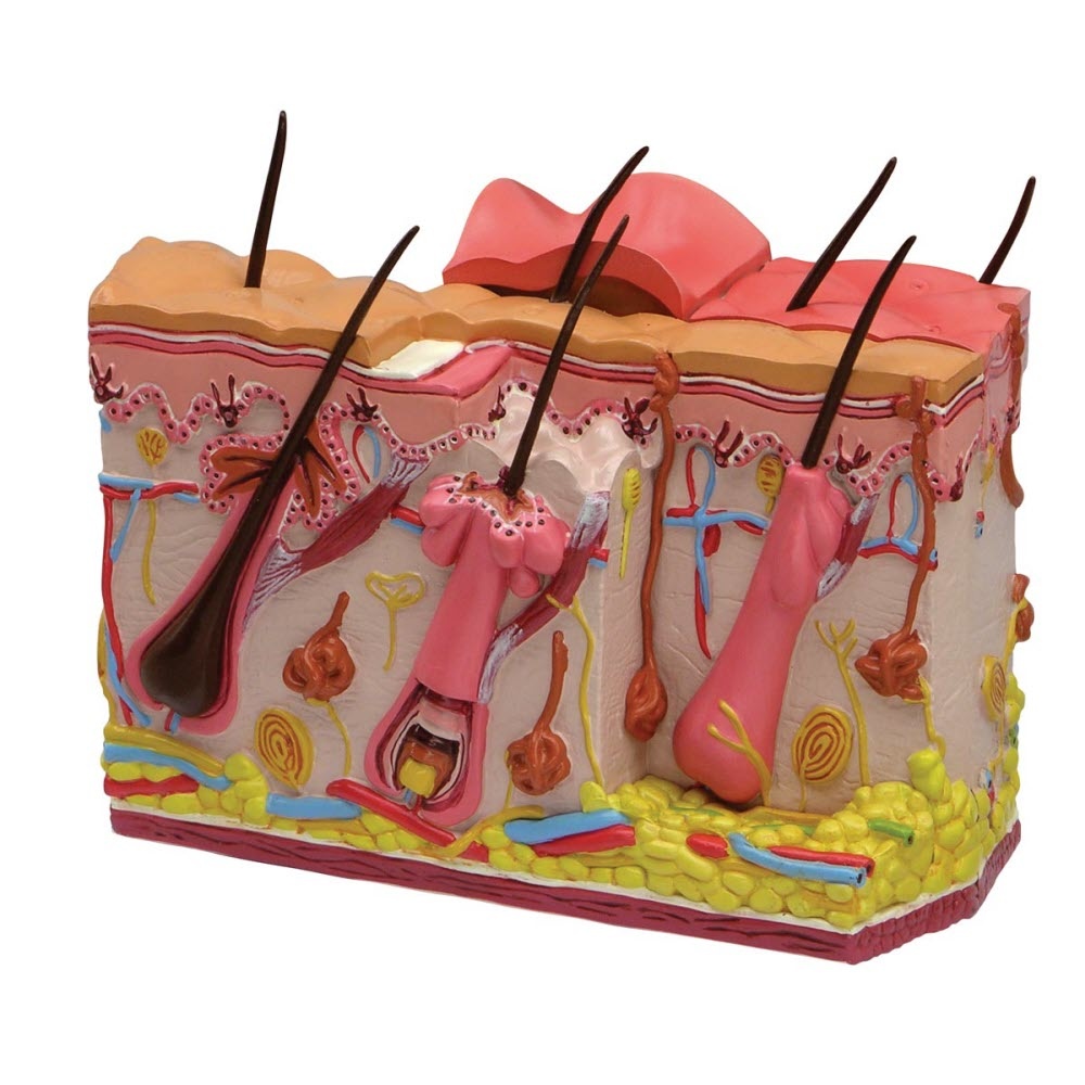 3B Scientific Anatomisch model van de Huid met eerste, tweede en derdegraads verbranding, foto 2 van 4