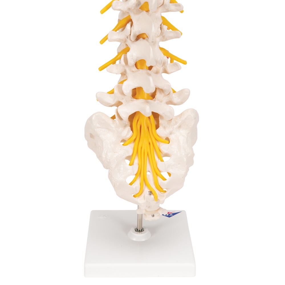 3B Scientific Lumbale wervelkolom met dorsolateraal verzakte tussenwervelschijf - 3B Scientific, foto 5 van 6
