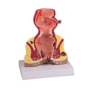 Erler Zimmer Anatomisch model van de rectum, doorsnede 1,5 maal vergroot