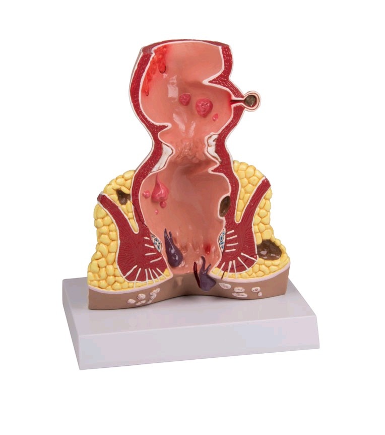 3B Scientific Anatomisch model van de rectum, doorsnede 1,5 maal vergroot, foto 2 van 4