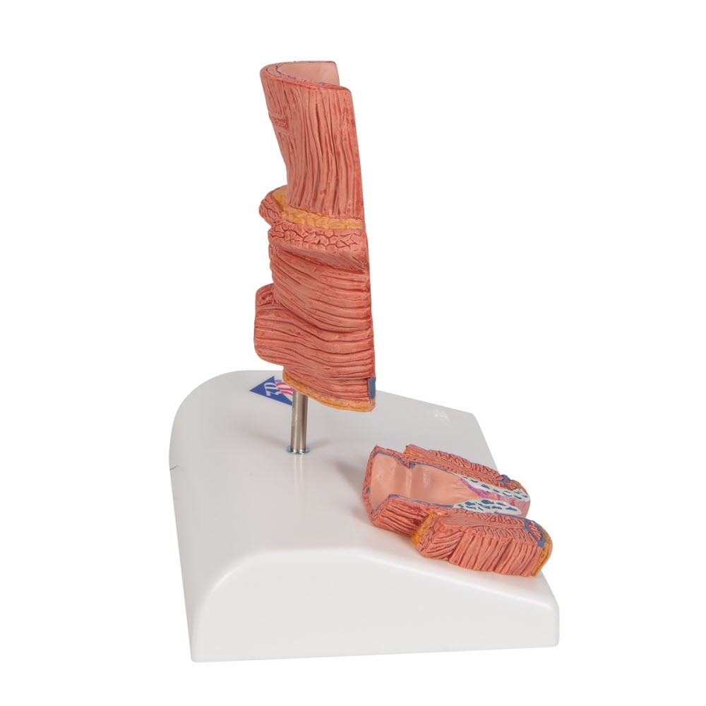 3B Scientific Anatomisch model van de rectum met Aambeien, foto 2 van 6