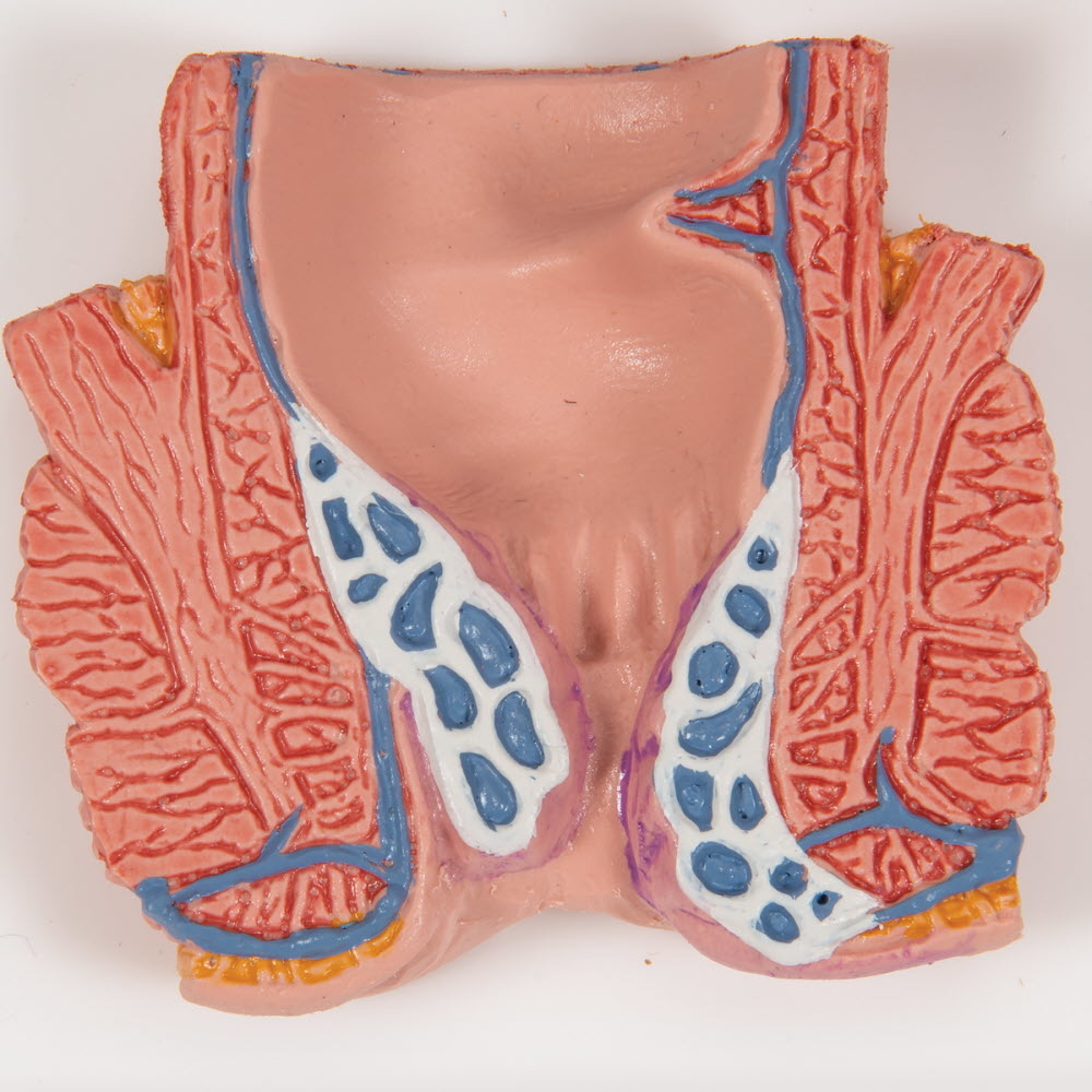 3B Scientific Anatomisch model van de rectum met Aambeien, foto 4 van 6