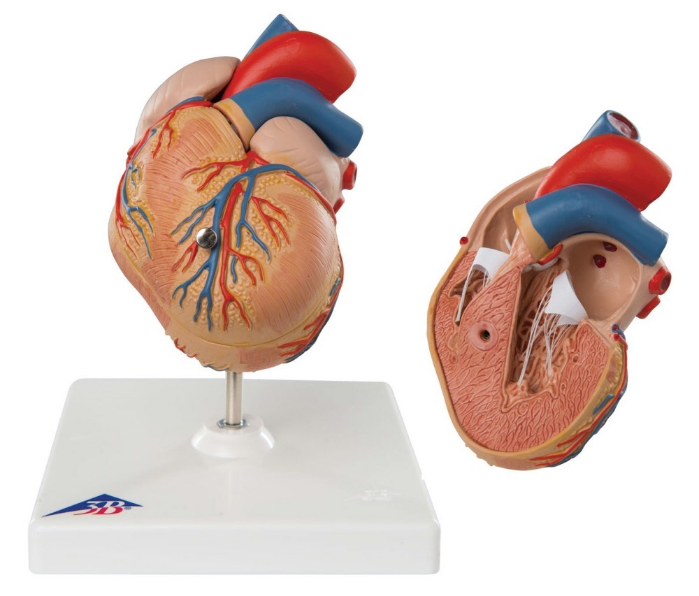3B Scientific Hart model 2 delig met linker ventrikel hypertrofie, foto 4 van 5