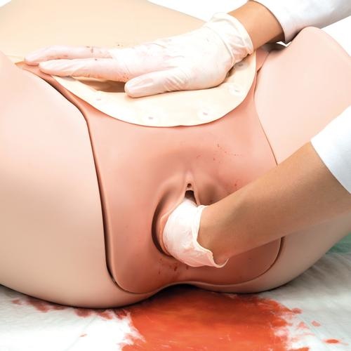 3B Scientific Hemorrhagia postpartum trainingsmodel - HPP trainingsmodel P97, foto 3 van 6