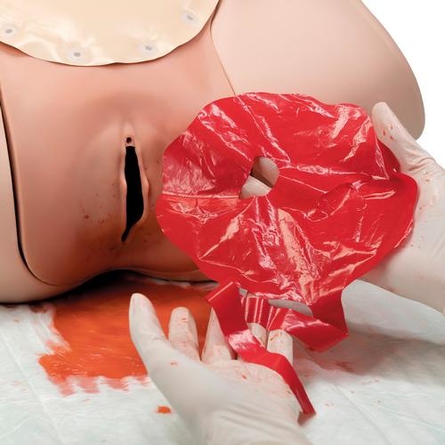 3B Scientific Hemorrhagia postpartum trainingsmodel - HPP trainingsmodel P97, foto 4 van 6