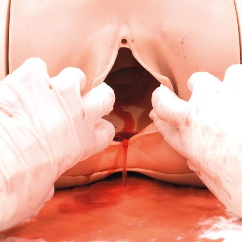 3B Scientific Hemorrhagia postpartum trainingsmodel - HPP trainingsmodel P97, foto 5 van 6