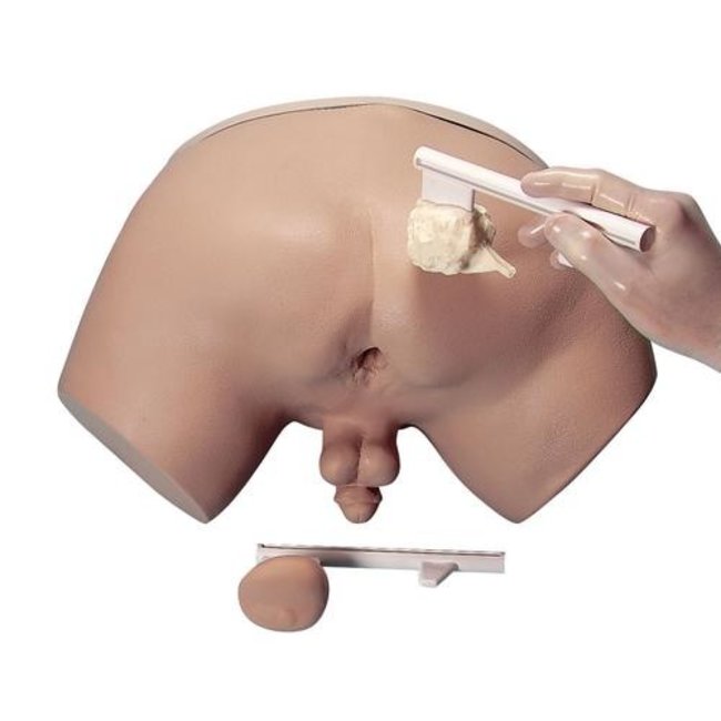 3B Scientific Prostaat-onderzoekssimulator: mannelijk onderlichaam met 4 verwisselbare prostaatklieren