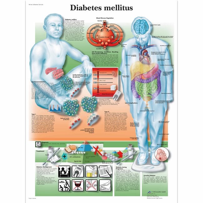 3B Scientific Anatomische poster Diabetes Mellitus