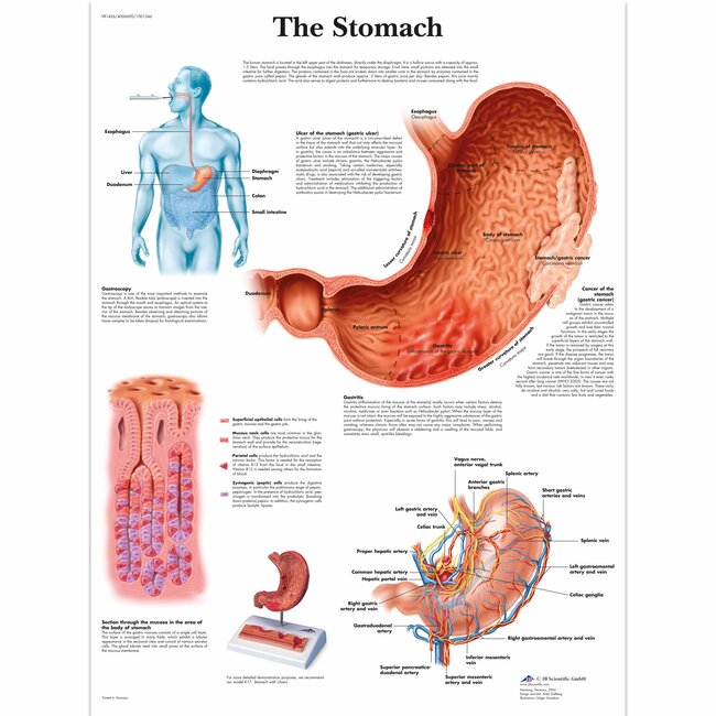 3B Scientific Anatomische Poster van de Maag