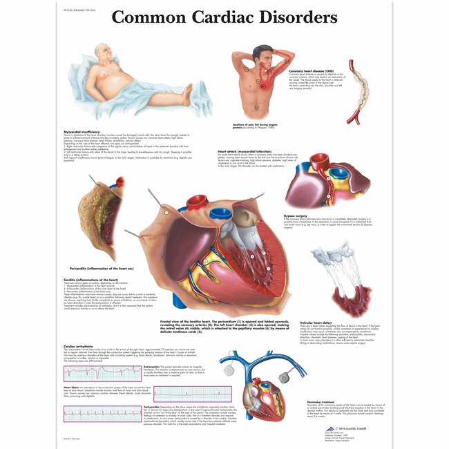 3B Scientific Anatomische Poster Common cardiac Disorders / Hartafwijkingen- Engels/Latijn