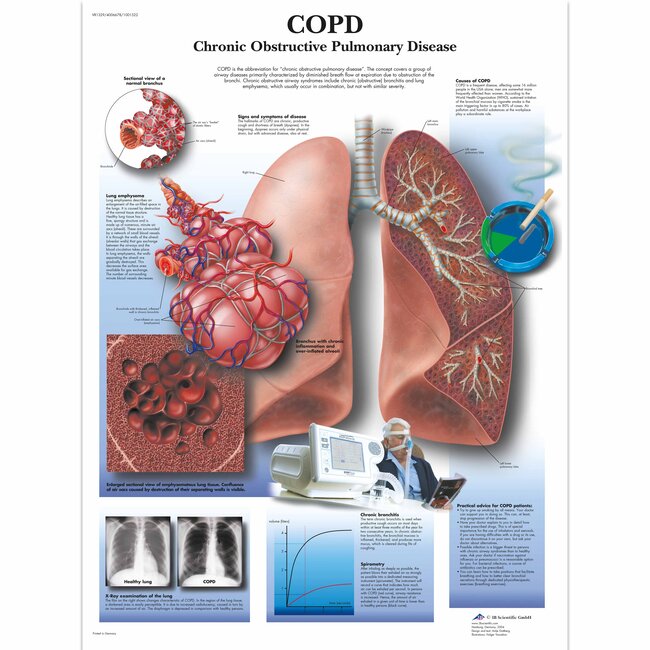 3B Scientific Anatomische Poster COPD - Chronic Obstructive Pulmonary Disease