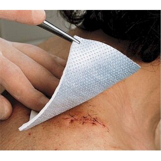 Noba Metalline compres 10x12cm - 10 stuks