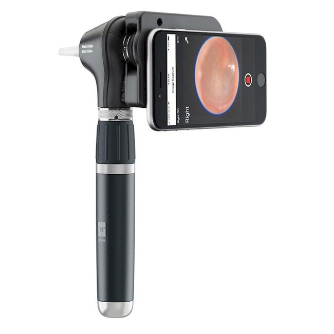Welch Allyn Macroview Plus otoscoop met oplaadbaar handvat
