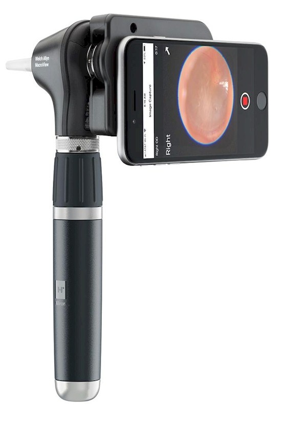 Welch Allyn Welch Allyn Macroview Plus otoscoop met oplaadbaar handvat - In Hardcase, foto 2 van 3