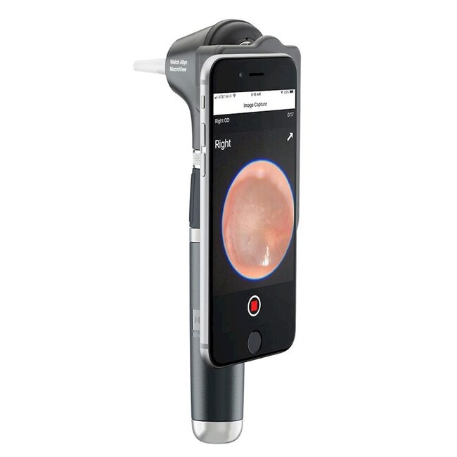 Welch Allyn Macroview Plus otoscoop met oplaadbaar handvat