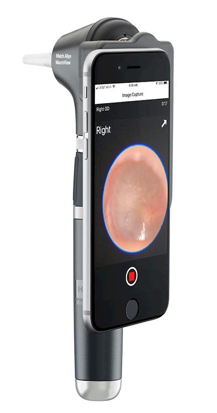 Welch Allyn Welch Allyn Macroview Plus otoscoop met oplaadbaar handvat - In Hardcase, foto 3 van 3