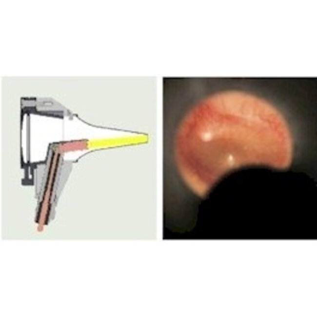 Basic Otoscoop - met LED verlichting