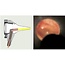 Basic Otoscoop - met LED verlichting