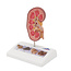 3B Scientific Model van de Nier met nierstenen