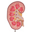 3B Scientific Model van de Nier met nierstenen
