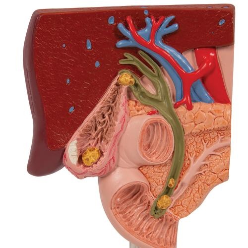 3B Scientific Anatomisch model Galstenen, foto 4 van 6