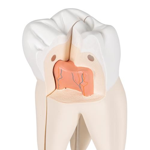 3B Scientific Anatomisch model bovenste kies 3 delig, foto 4 van 6
