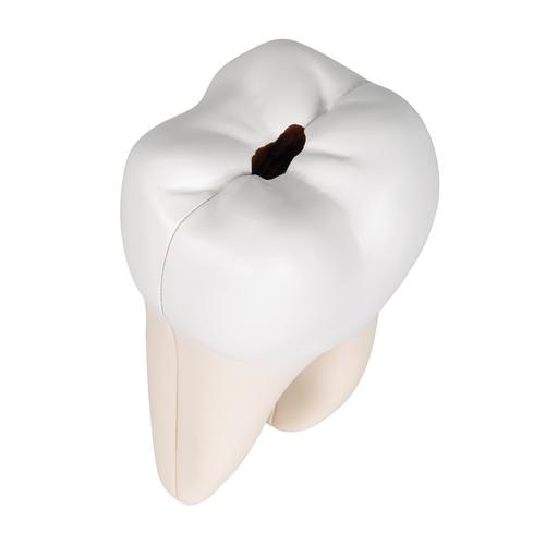 3B Scientific Anatomisch model van een dubbele wortel kies met cariës - 3B Scientific, foto 3 van 6