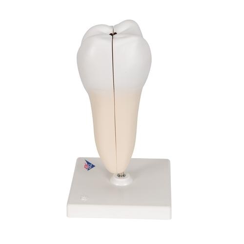 3B Scientific Anatomisch model van een dubbele wortel kies met cariës - 3B Scientific, foto 5 van 6