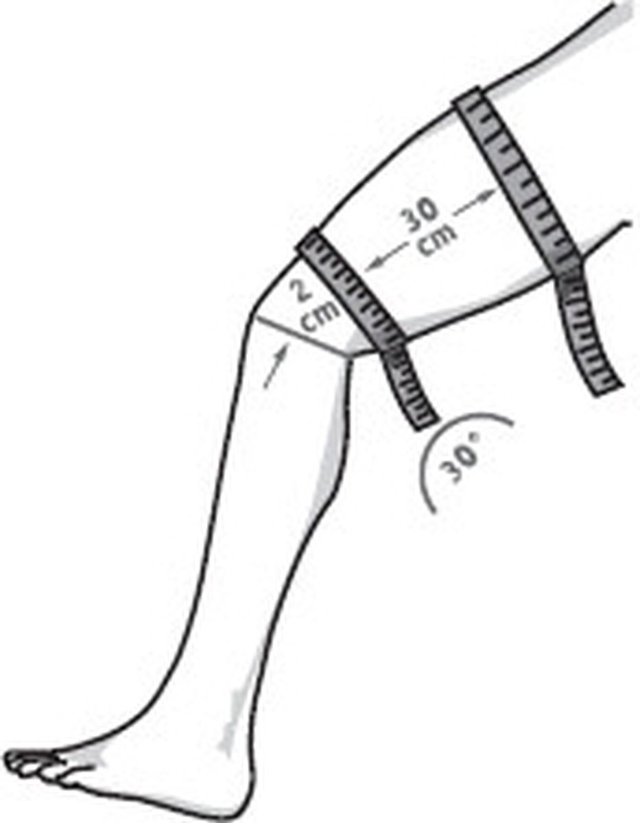 Bauerfeind MyoTrain dijbeenbandage, foto 4 van 5