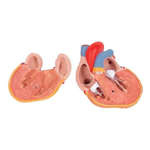 3B Scientific Hart model 2 delig met linker ventrikel hypertrofie, foto 3 van 5