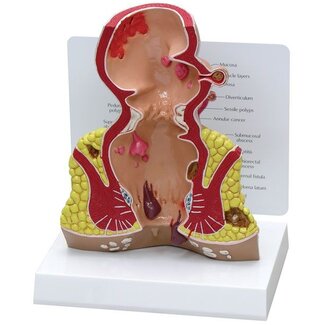 3B Scientific Anatomisch model van de rectum, doorsnede 1,5 maal vergroot