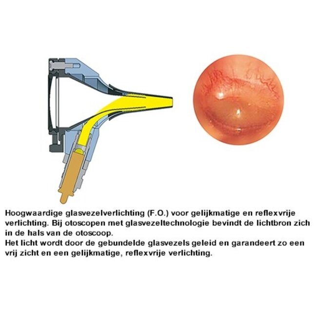 Heine Heine K180 LED Otoscoopkop los - zonder trechters - 3,5vlt.