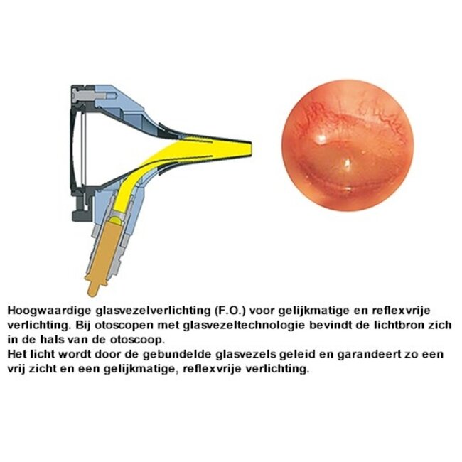 Heine K180 LED Otoscoopkop los - Incl. 4 trechters - 3,5vlt.
