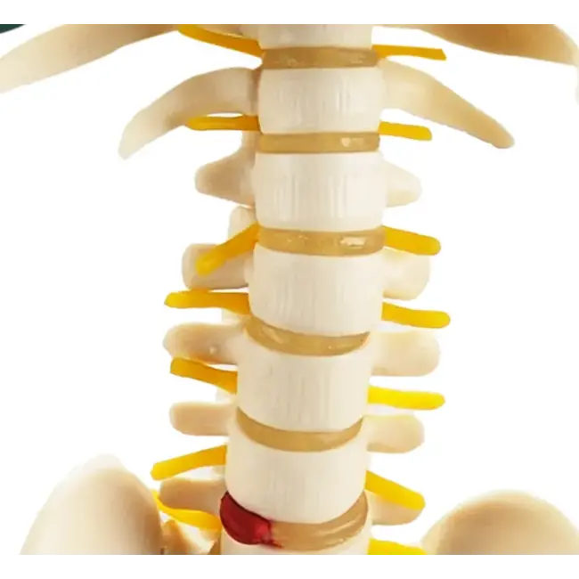 Anatomisch Skelet | 85 cm | Met zenuwwortels, halsslagaders en herniaschijf | Budget model